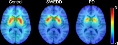 Nigral volumetric and microstructural measures in individuals with scans without evidence of dopaminergic deficit